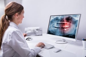 A dentist that is examining a dental x-ray of a patient.