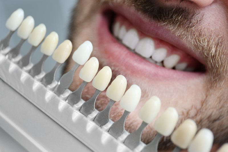 Young man choosing color of tooth with a shade guide at the dentist.