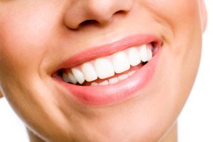 Close-up view of a woman's smile.