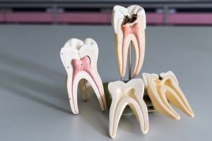 Dental tooth models that show images of tooth roots and root canals