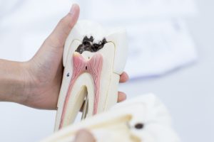 A dental professional holding a dental model that shows all the layers of the teeth.