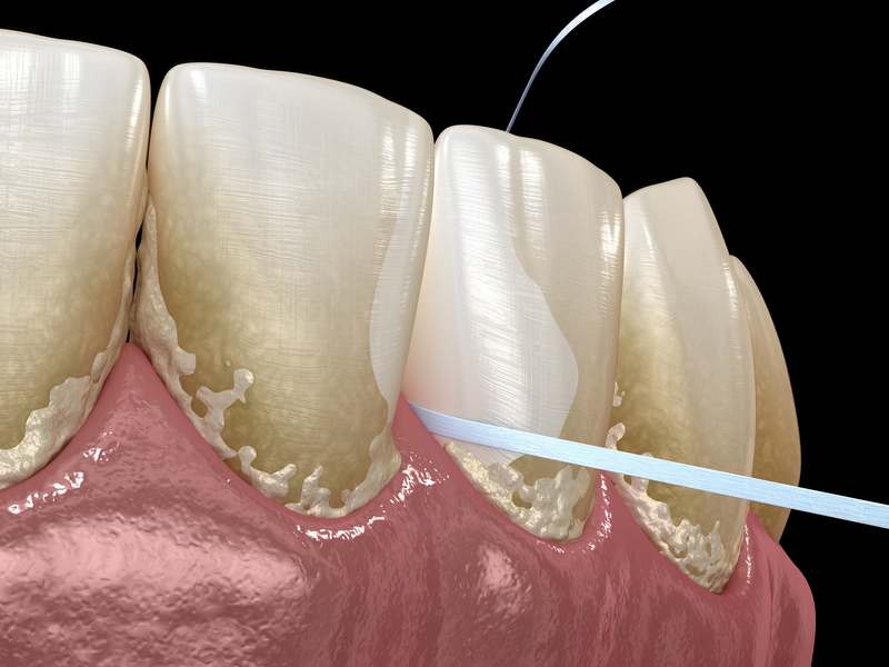 Animated model of a person's teeth being flossed.