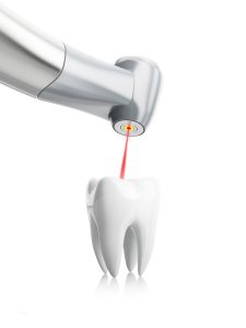 Dental Laser Tissue Treatment