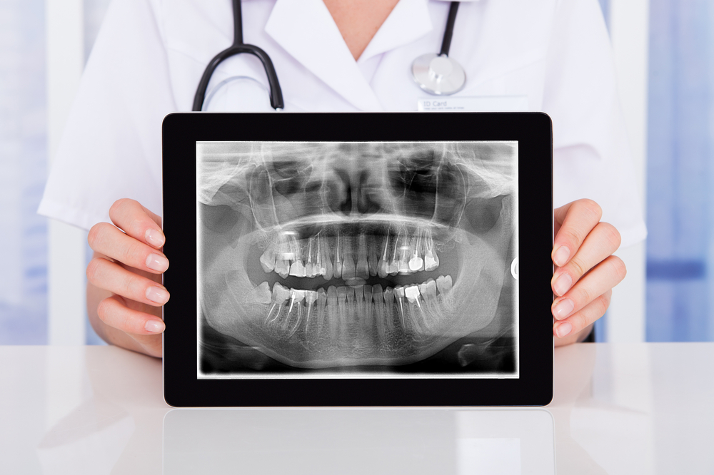 Digital Dental X-rays Fort Collins