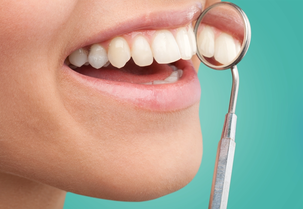 cosmetic bonding